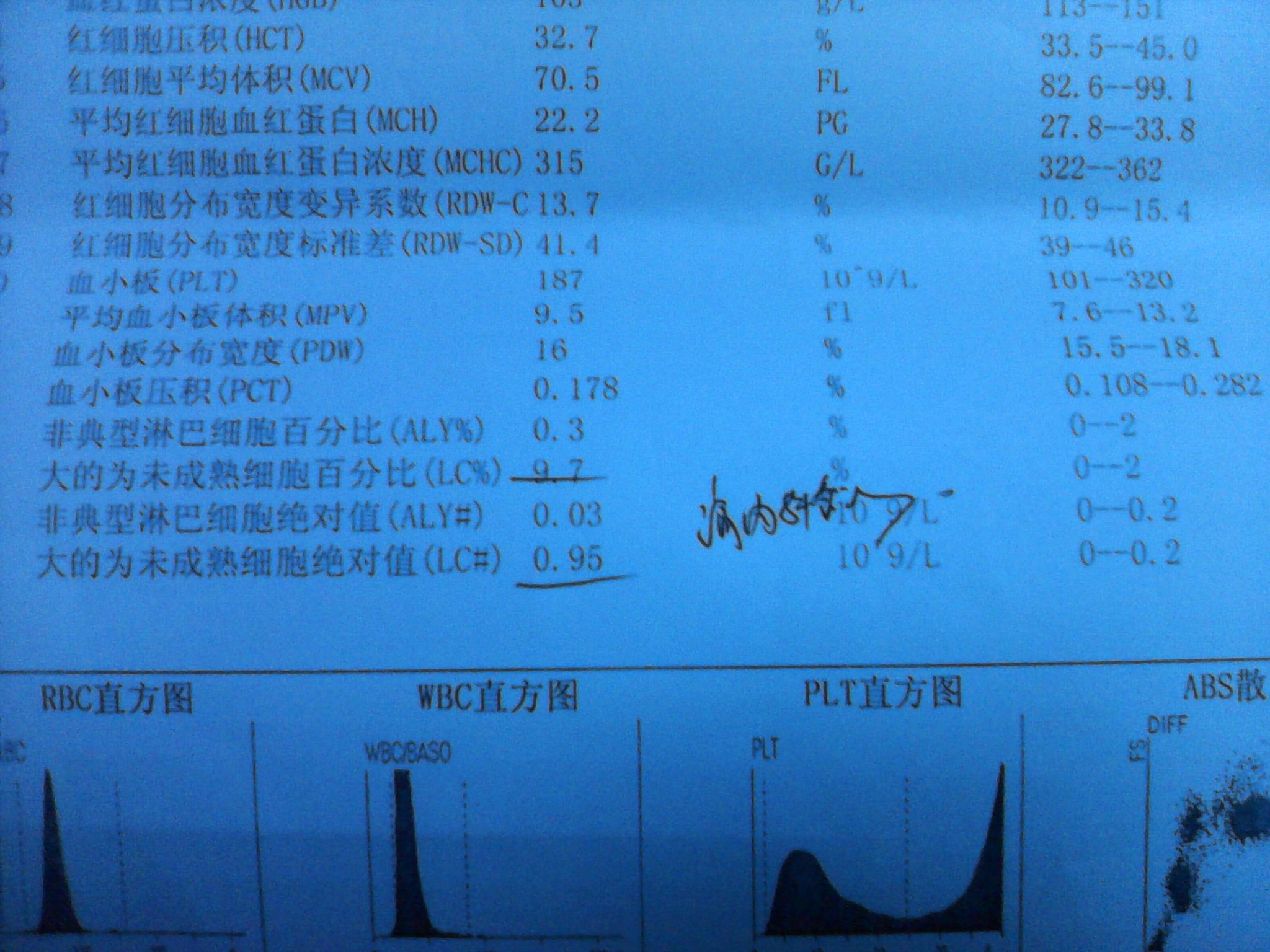 孕婦血常規中報告大的為未成熟粒細胞百分比97參考值是0