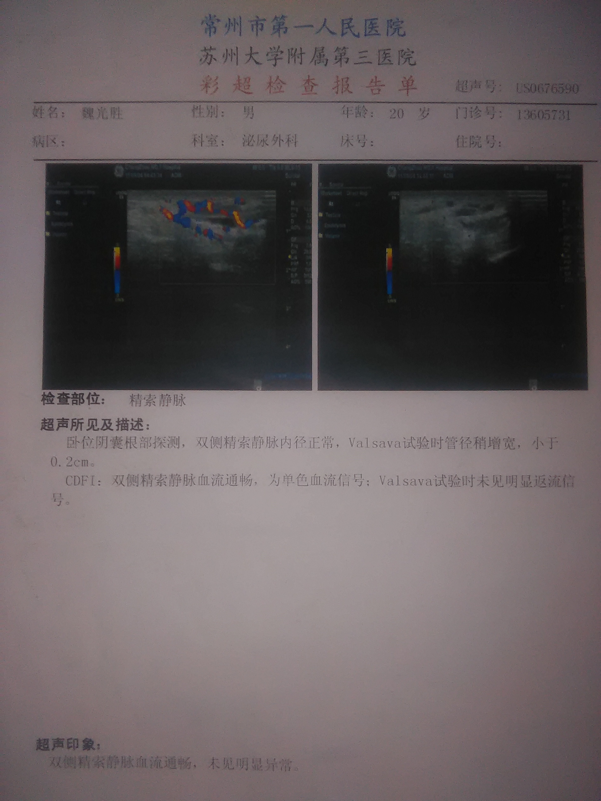 有過四年的史現有症狀每天不停地睪丸小腹牽連疼有一個