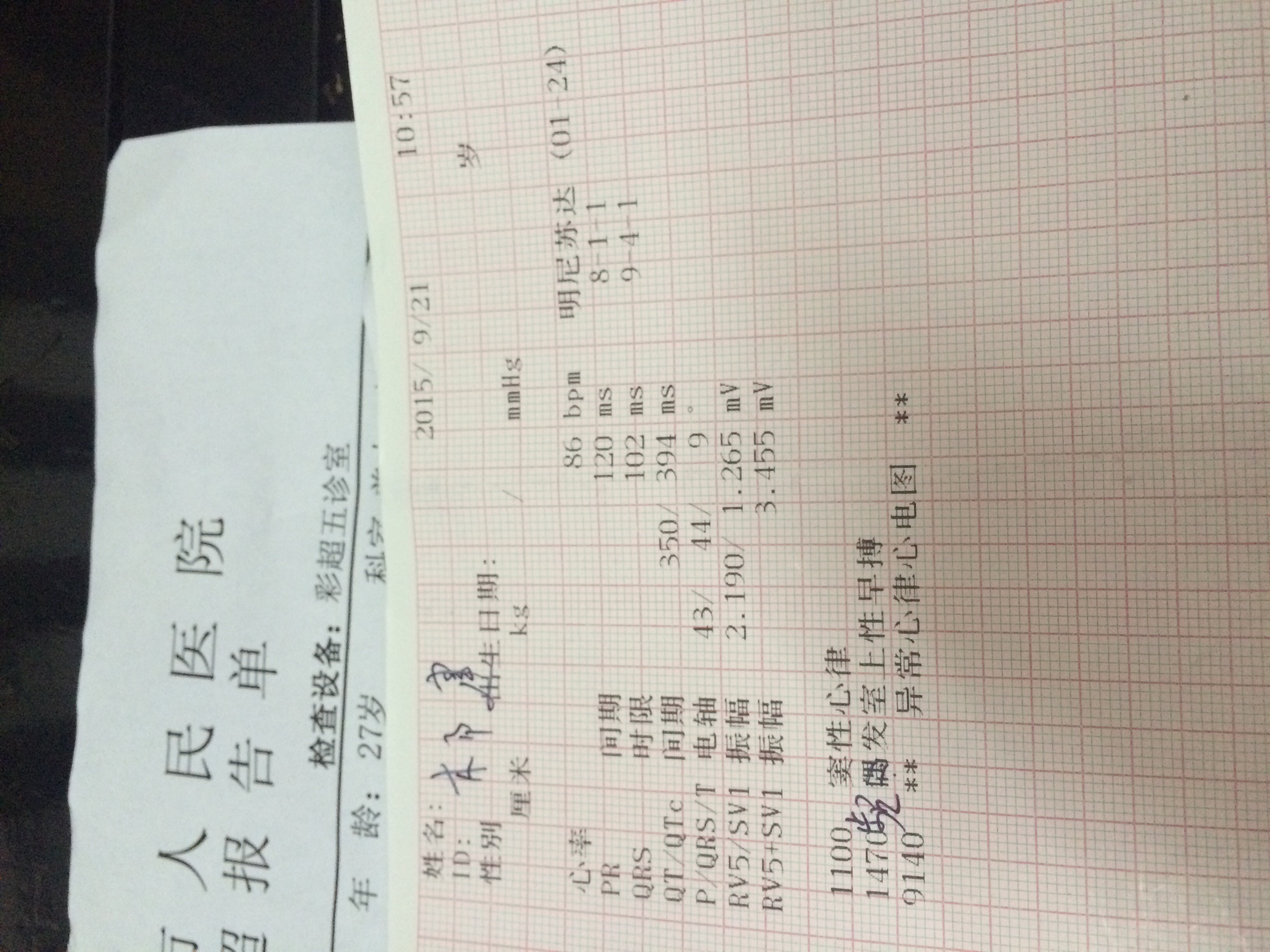 想問下醫生我的心臟問題嚴重不有時候心電圖是正常的但是今天