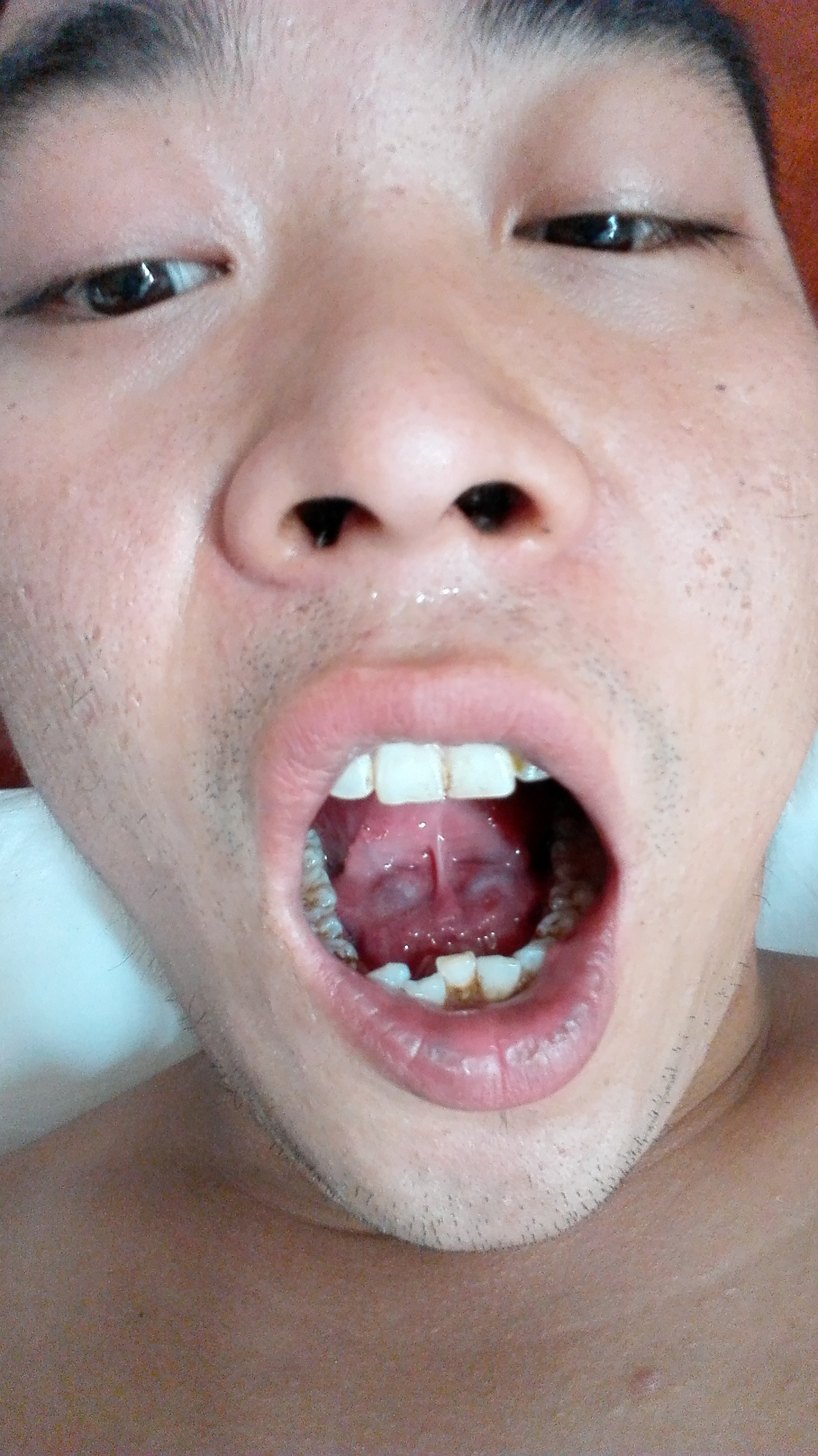 舌头下方图片图片