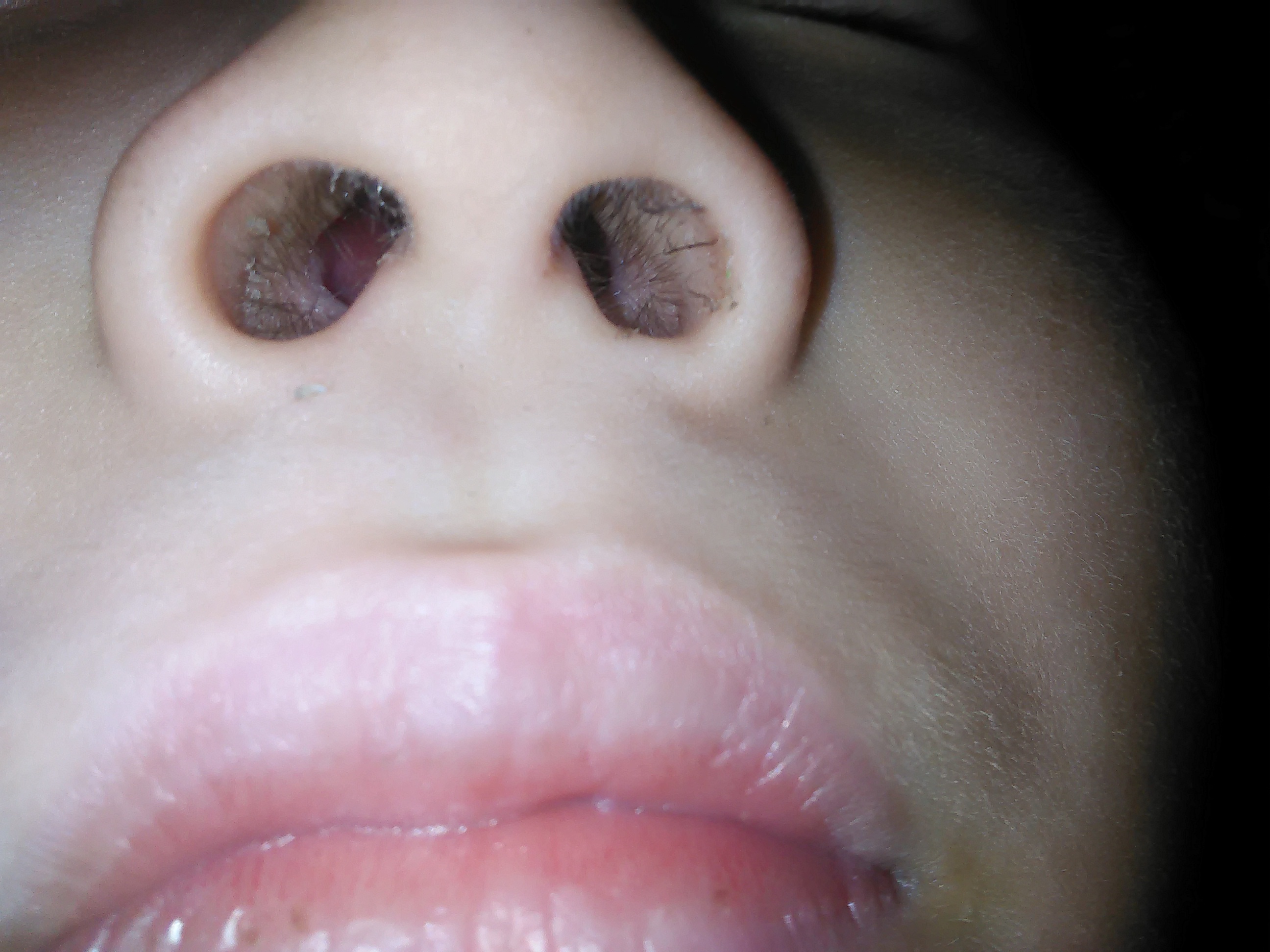 儿童鼻子内部图片图片