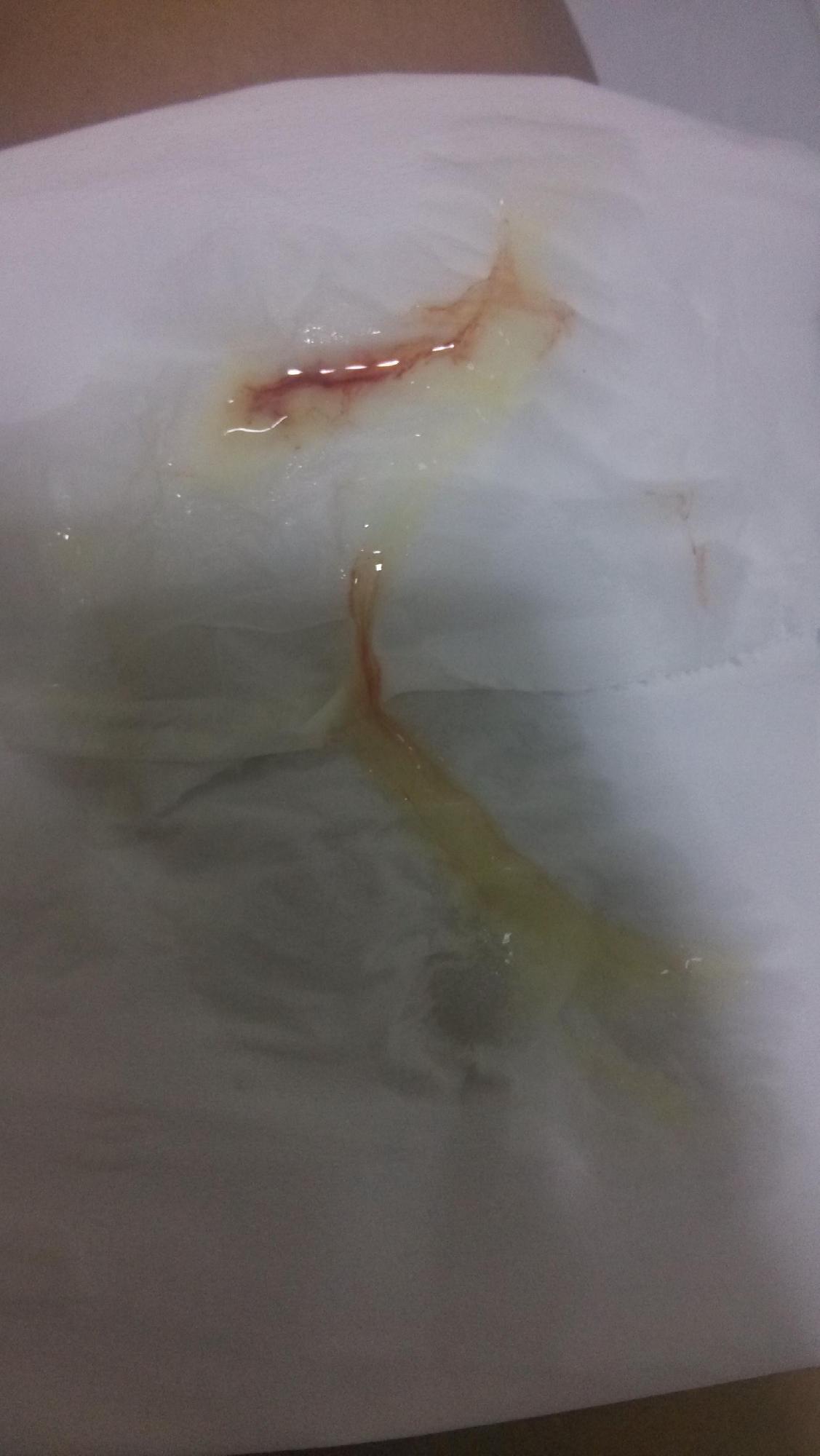 排卵期白带带血的图片图片