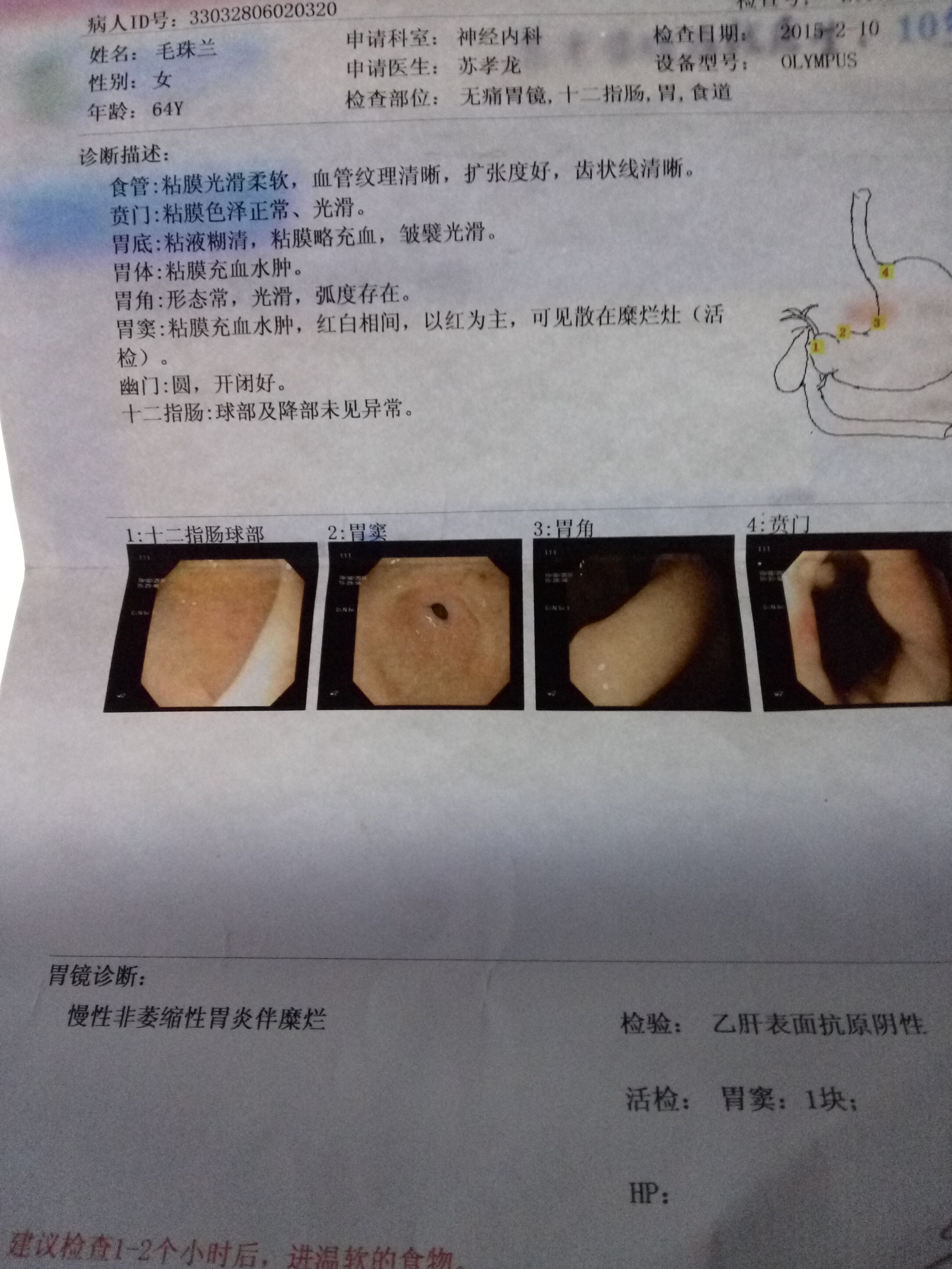 正常的胃镜报告图图片