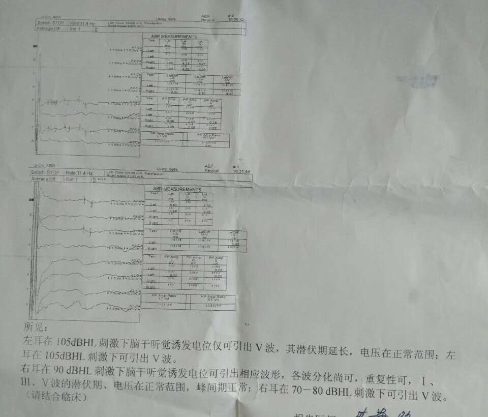 小孩四周岁,做了听力脑干诱发定位,请医生朋友帮忙看下检查结果