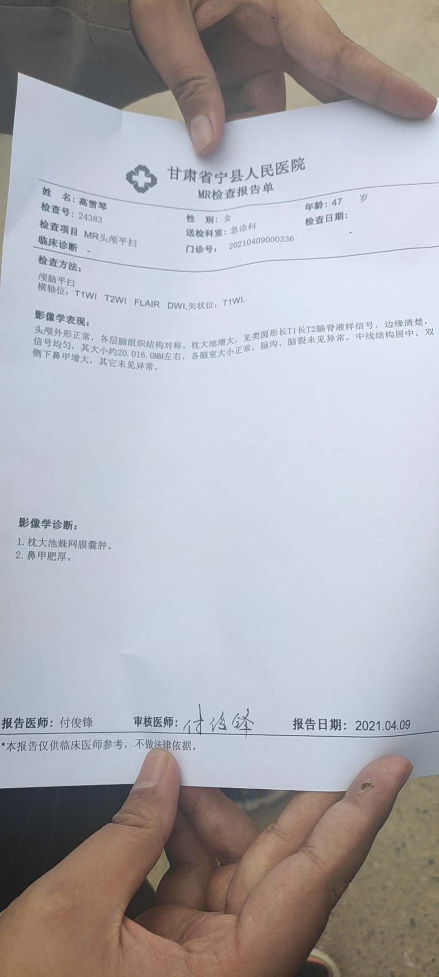 最近一直頭疼頭暈做了個磁共振檢查結果是枕大池蛛網膜囊腫好